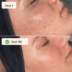 GANT EXFOLIANTS POILS INCARNES