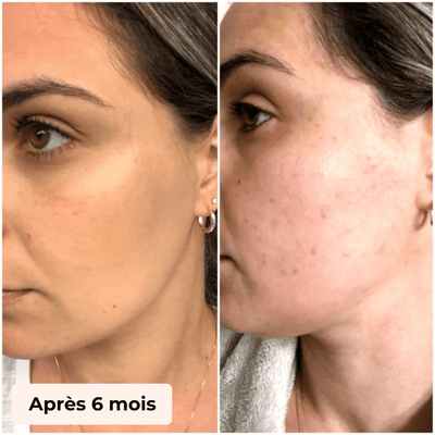 GANT EXFOLIANTS POILS INCARNES