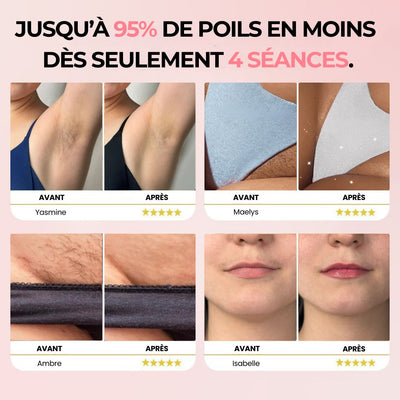 IPL LUNARIS • ÉPILATEUR À LUMIÈRE PULSÉE