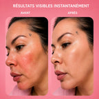 LunaRed - Avant/après traitement luminosité teint peau LED