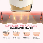 IPL PRO • ÉPILATEUR À LUMIÈRE PULSÉE