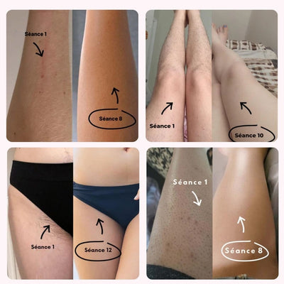PACK EPILATION • EXFOLIANT, EPILATION & HYDRATATION